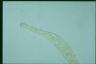 Spirostomum