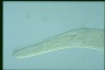 Spirostomum