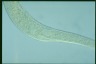 Spirostomum