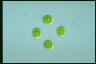 Asterococcus