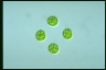 Asterococcus superbus