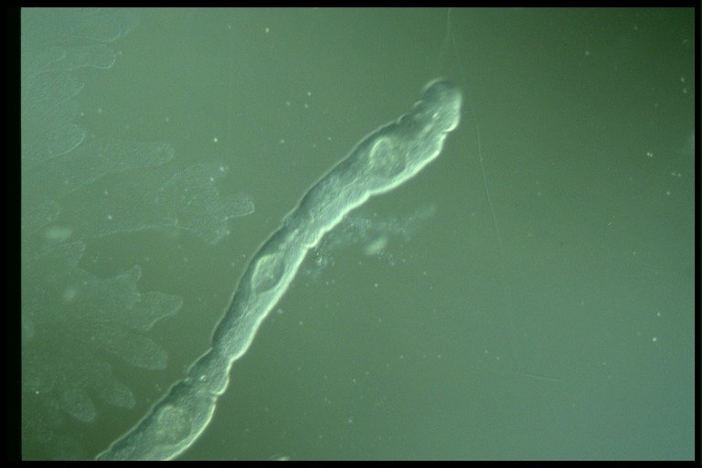 protist image