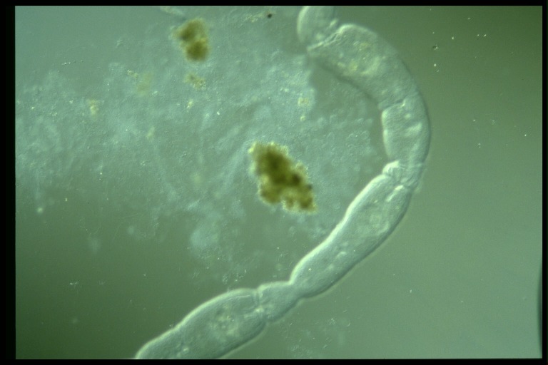 protist image