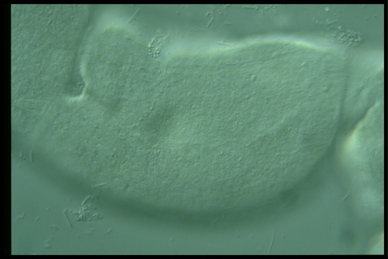 protist image