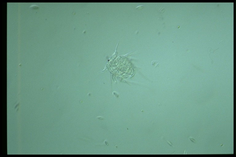 protist image