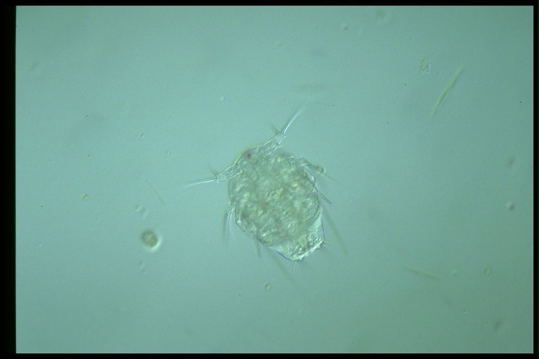 protist image