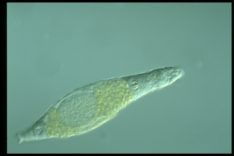 protist image