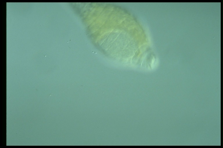 protist image