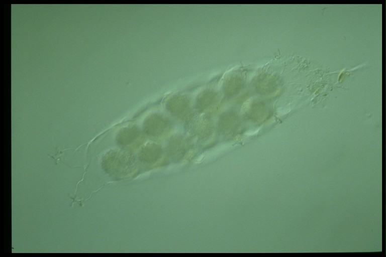 protist image