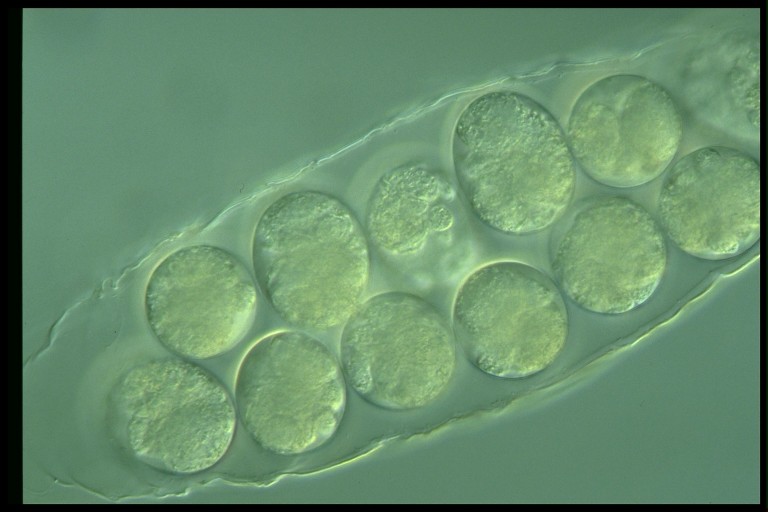 protist image