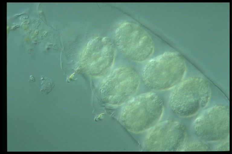 protist image