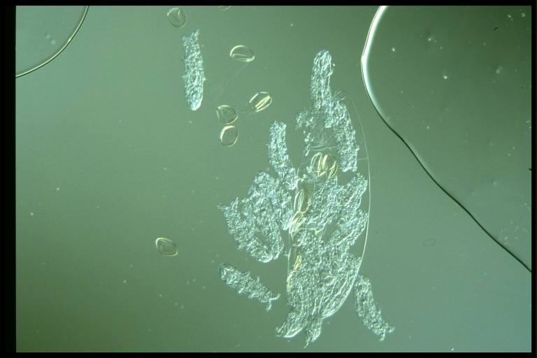 protist image