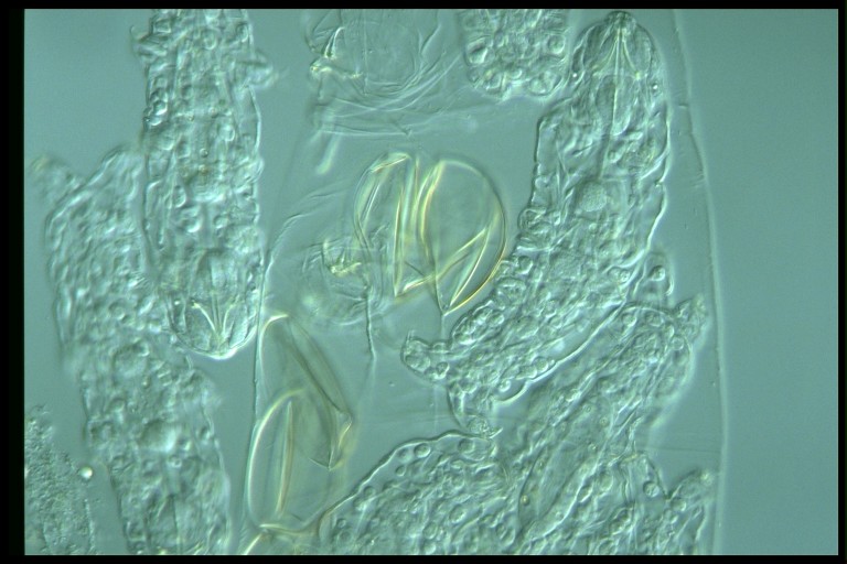 protist image