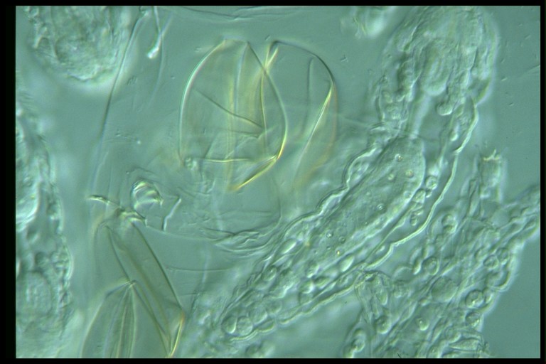 protist image