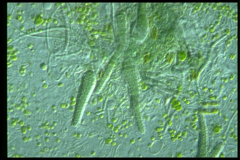 protist image