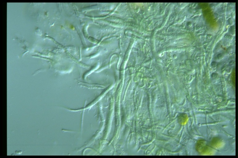 protist image