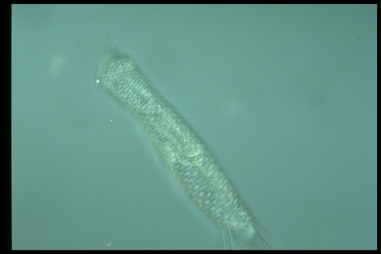 protist image