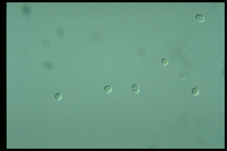 protist image