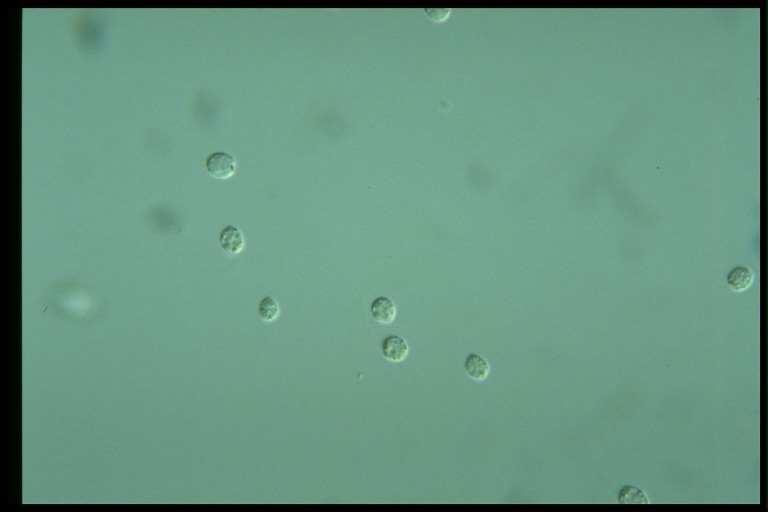 protist image