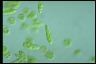 Euglena gracilis