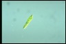 Euglena gracilis