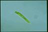 Euglena oxyuris