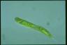 Euglena oxyuris