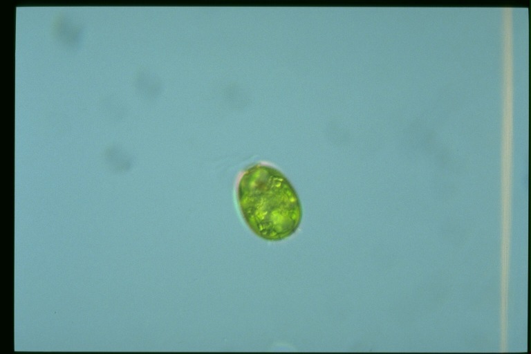 protist image