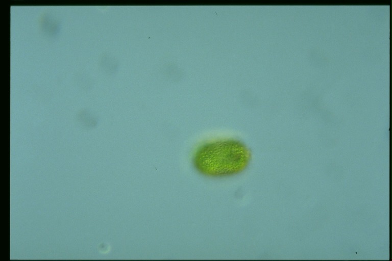 protist image