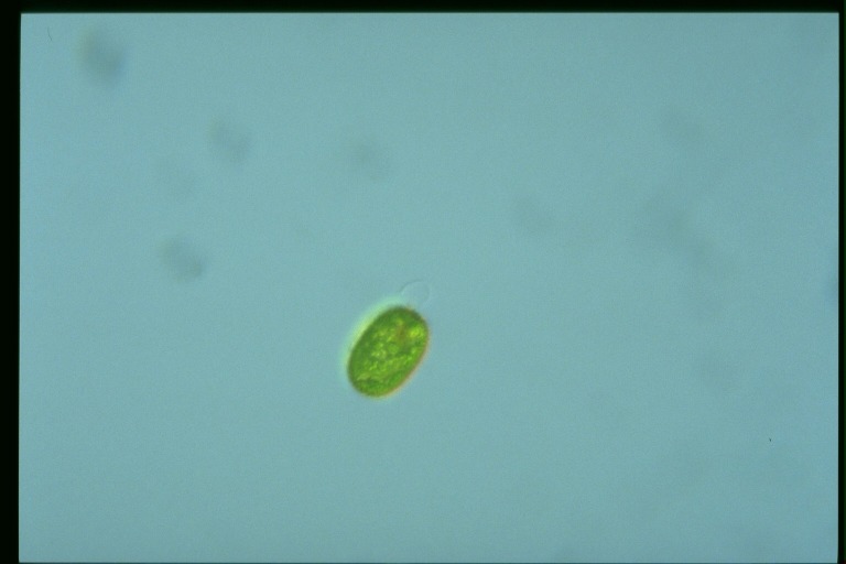 protist image