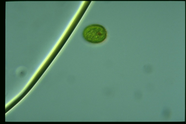 protist image