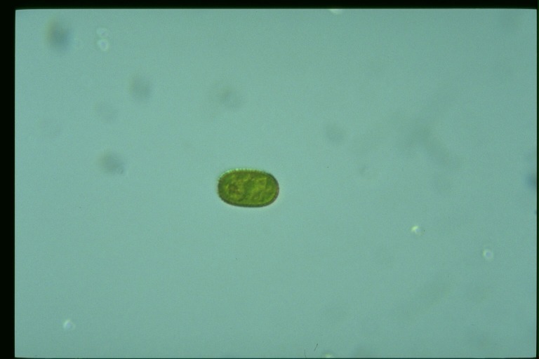 protist image