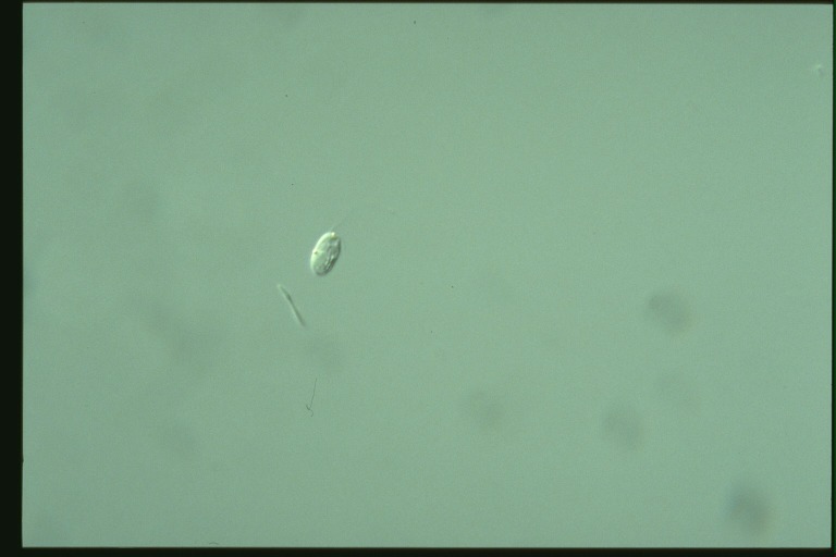 protist image