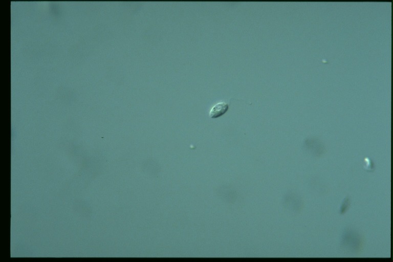 protist image