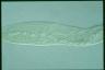 Spirostomum ambiguum