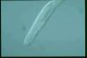 Spirostomum teres