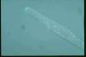 Spirostomum teres