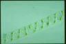 Spirogyra