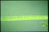 Spirogyra