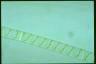 Spirogyra