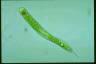 Euglena oxyuris