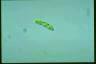 Euglena