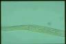 Spirostomum teres