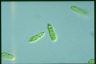 Euglena gracilis