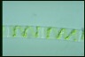 Spirogyra