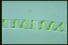 Spirogyra