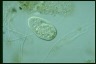 Paramecium trichium