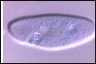 Ophryoglena