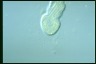 Ophryoglena