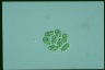 Glaucocystis